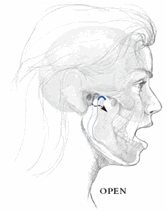 Description: Profile of open mouth showing condyle gliding along the joint socket of the temporal bone